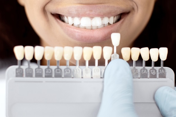 What&#    ;s Involved In The Dental Bonding Procedure?