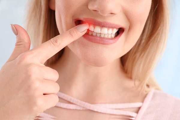 Can Gum Disease Be Treated At Home?